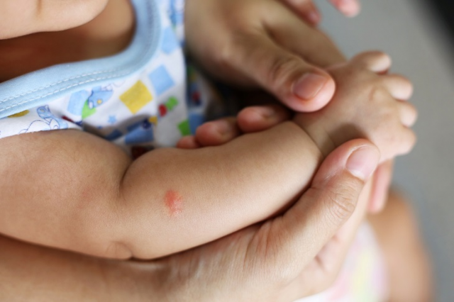 Làm cách nào để điều trị vết côn trùng cắn ở trẻ?