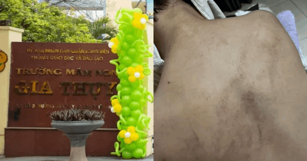 Sự việc giáo viên bị tố bạo hành tại Trường mầm non Gia Thụy, Phường Bồ Đề: Nhà trường đang phối hợp điều tra